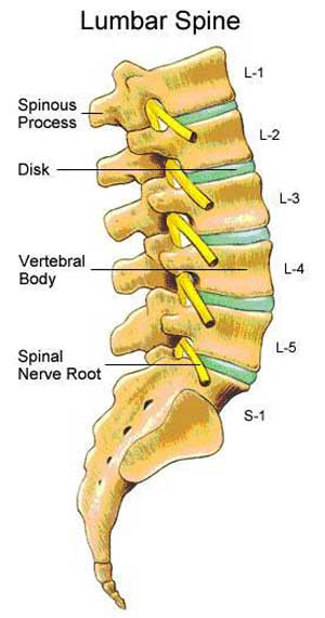 Lumbar Spine Injury Illustration - High Impact® Visual Litigation  Strategies™